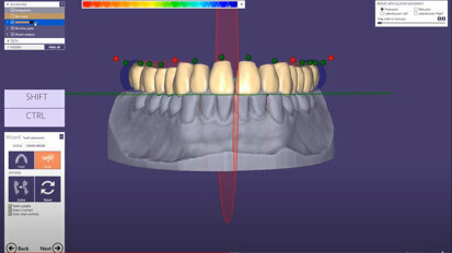exocad Quick Guide: Designing a single arch denture
