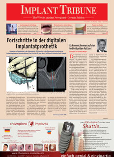 Implant Tribune Germany No. 2, 2014