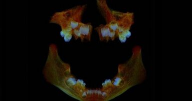 Anglo-Saxon teeth could help identify modern health issues, study finds