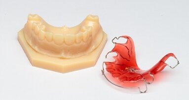 3D-printen in tandheelkunde