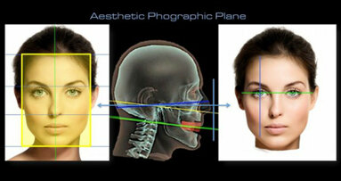 Aesthetic Digital Smile Design ADSD : dentisterie esthétique assistée par ordinateur – Partie I
