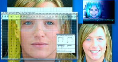 Aesthetic Digital  Smile Design: odontoiatria estetica software assistita
