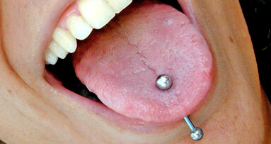 California Dental Association says oral piercings pose significant dangers to oral health