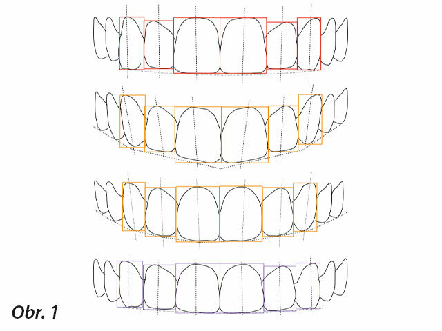 Když zubní lékař poprvé hodnotí nového pacienta s problémy v estetice chrupu, může přehlédnout mnoho zásadních faktorů. Slovní výměna informací by měla být převedena do vizuální podoby, aby pomohla pochopit, jaká může mít pacient a zubní lékař očekávání na konci ošetření. Základní prostředky této komunikace začínají u 3D náhledu na návrh ošetření v ústech pacienta (APT: Aesthetic Pre-evaluative Temporaries – tj. estetické preevaluativní provizorní náhrady), který je vhodné diskutovat s pacientem ještě před naplánováním ošetření. Nezáleží na tom, jakým klinickým obtížím bude zubní lékař čelit a jak problémy technicky vyřeší.