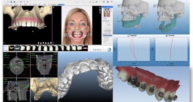 Ortodoncia Digital: ¿Una revolución solo tecnológica?