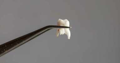 Algoritmos de aprendizado de máquina podem ajudar na previsão da perda dentária