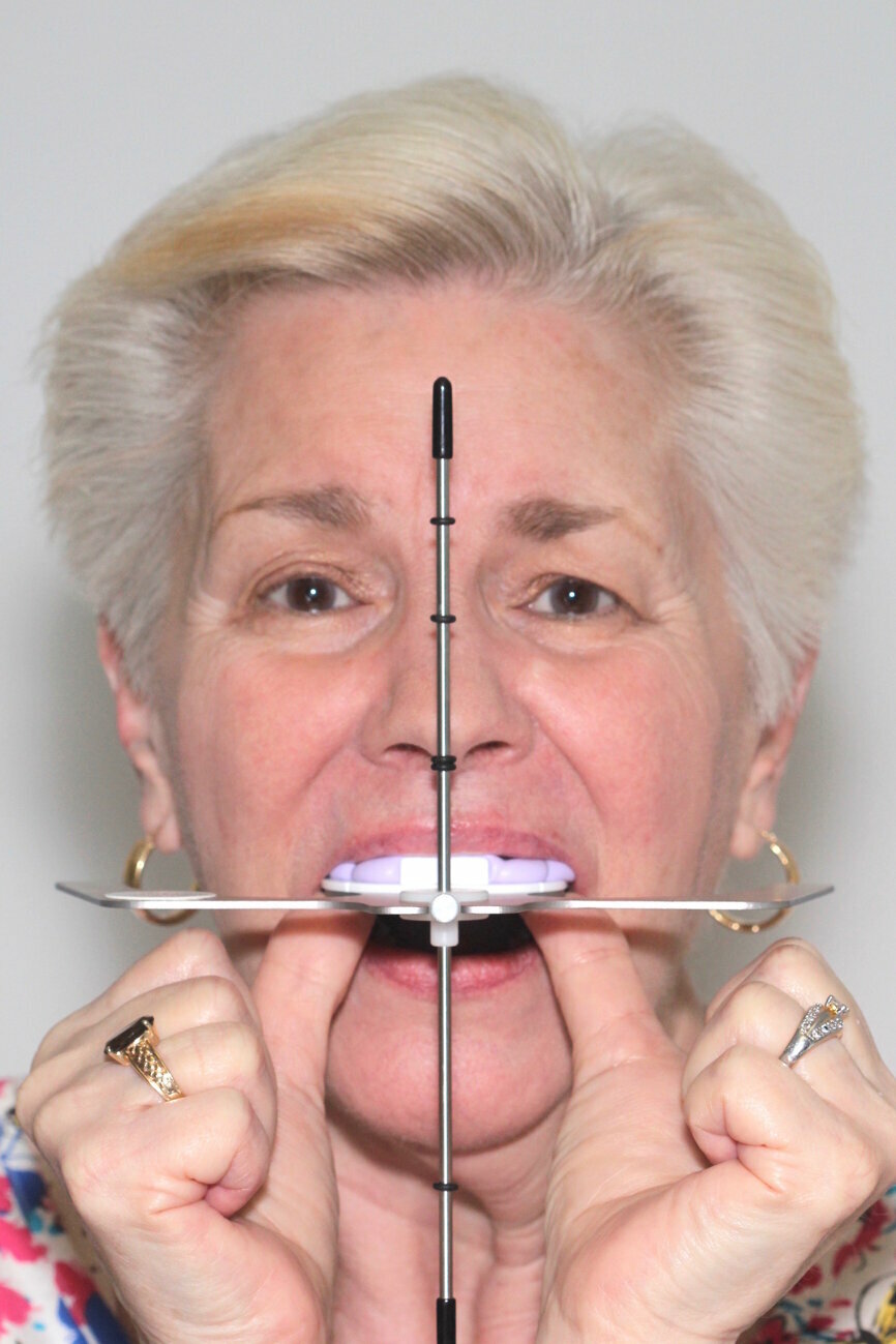 Fig. 2: Patient holding the Kois Dento-Facial Analyzer System; the middle rod corresponds to the facial midline and the Fox plane is parallel to the interpupillary line.