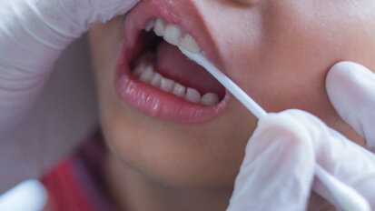 Fluoridni premaz na mlečnih zobeh pozitivno vpliva na preprečevanje kariesa