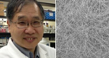 Engenharia de tecidos: fibras da seda poderiam promover regeneração de células salivares