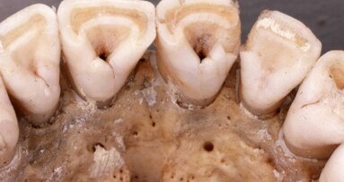 Shovel-shaped incisors a result of genetic mutation from last ice age