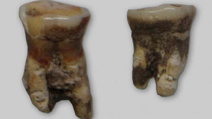 Ancient tooth from Mesolithic ancestor reveals diet