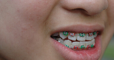 Orthodontic patient starts increased in 2010