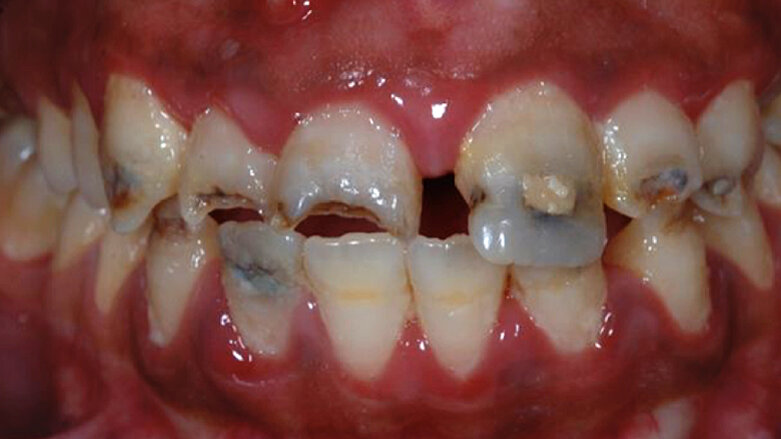 Estética dental y comunicación con el paciente