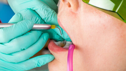 BIOLASE and DCA plan to expand laser adoption in dental offices