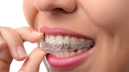 „Zanedlouho bude polovina veškeré ortodontické terapie realizována fóliovými aparáty“