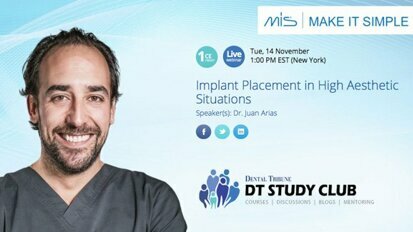 Free webinar: Expert to lecture on implant placement in the aesthetic zone