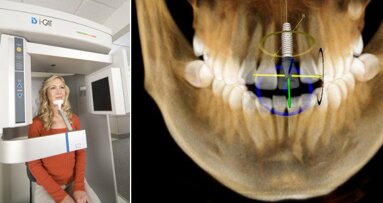 KaVo e Henry Schein anunciam agenda para Congresso Odontológico de Imagem 3-D