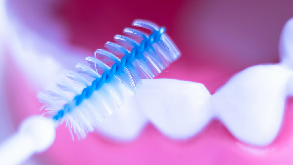Cepillos interdentales y palillos de goma para la periodontitis