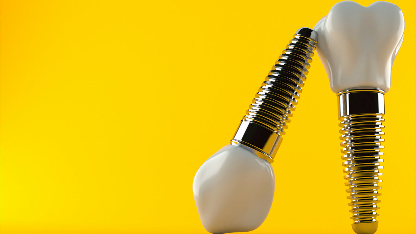 Dental News Trends in dentistry What is currently happening in