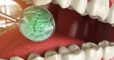 Ново изследване проучва бактериите, причиняващи орални заболявания