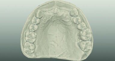 Materials and systems for all ceramic CAD/CAM restorations