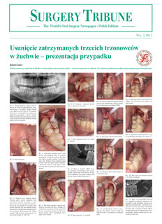 Surgery Tribune Poland No. 1, 2016