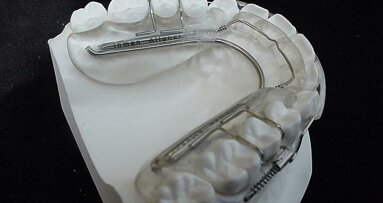 Ethical smile design with the Inman Aligner―A case study
