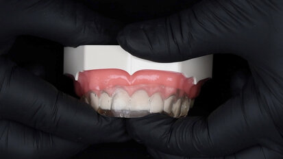 Flowable injection technique: How to avoid air bubbles in composite restorations