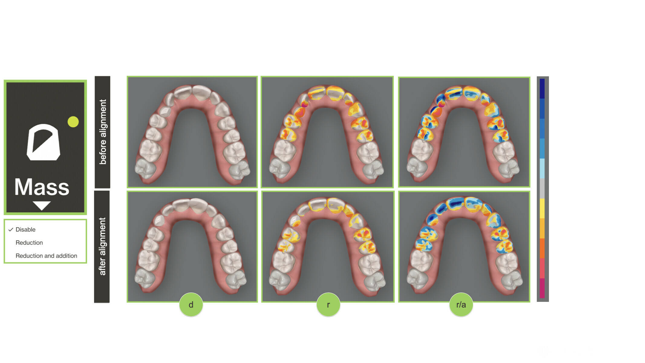 Virtual Integration With Invisalign Smile Architect - Finance Ambitions