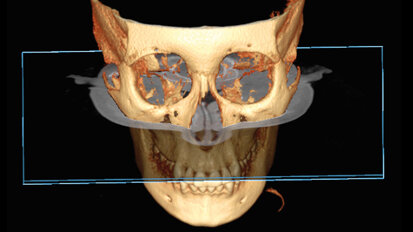 Význam 3D zobrazovacích systémů v současné ortodoncii