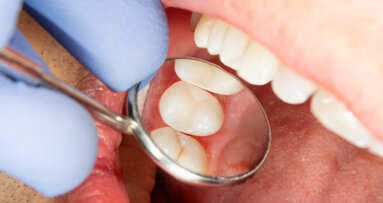 Transforming dentistry: Direct restoration procedures simplified