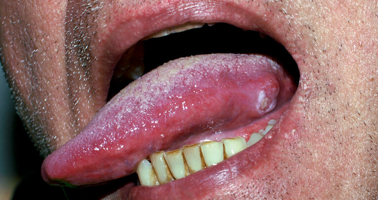 Researchers investigate how tongue reacts to different textures in food