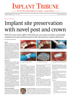 Implant Tribune Canada