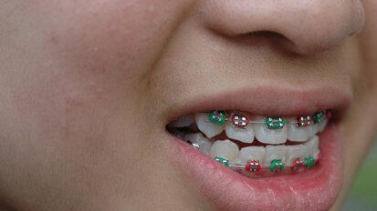 Orthodontic patient starts increased in 2010