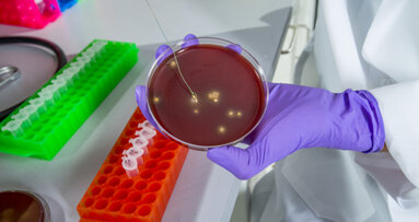 Report finds disposable bib holders eliminate risk of bacterial transmission