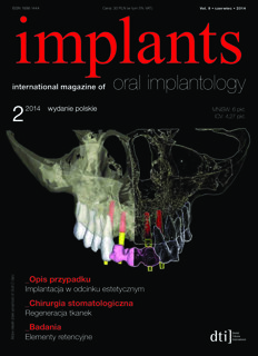 implants Poland No. 2, 2014