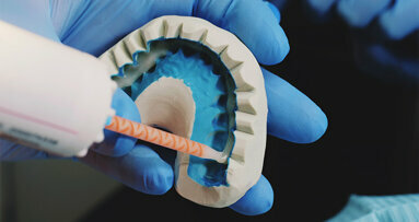 New glue could be dentistry game changer