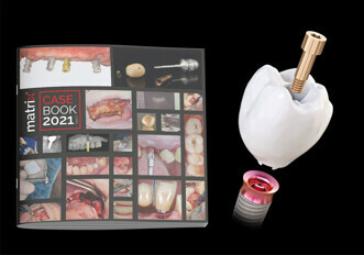 TRI Dental Implants – matrix case book