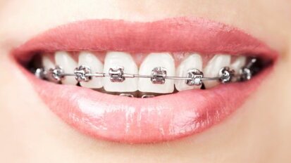 Boetes bij verkeerd titelgebruik orthodontie
