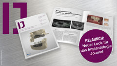 Relaunch: Neuer Look für das Implantologie Journal
