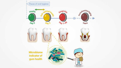 歯肉炎、歯周炎、加齢をつなぐ歯肉の無症状状態を特定した研究