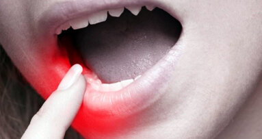 Professional help a must for long-term tooth sensitivity cure
