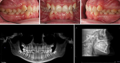 Orthodontic treatment changes and efficiencies during COVID-19 pandemic