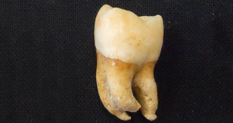 Researchers discover method to control tooth root development