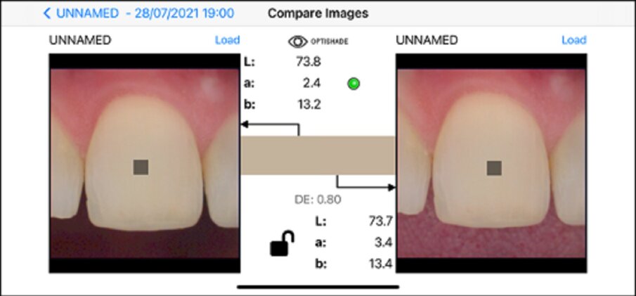 Fig. 11e: Same tooth, same surface (clean), same time frame, same positioning, same device, *different background. Shade difference: 0.89. Unreliable measurement. The asterisk indicates the parameter critical to the reliability of the measurement.