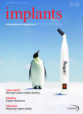 implants international No. 3, 2018