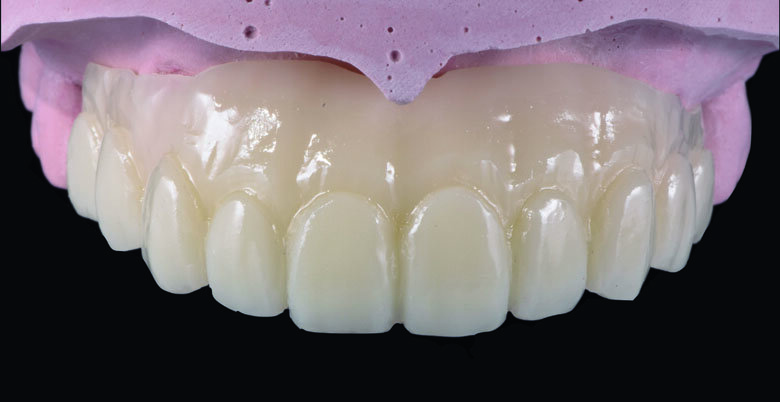 Fig 13. CeraResin bond 1 and 2 (CRB1 and CRB2) were applied to bond the Ceramage  pink composite. 