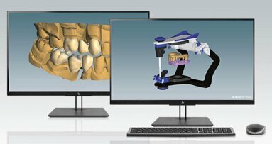 Latest Ceramill software update offers new opportunities for in-house fabrication