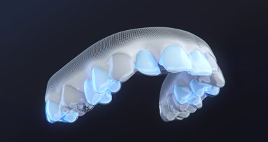 Align Technology introduces invisalign moderate package in the Middle East market