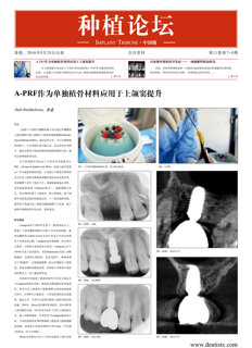 Implant Tribune China No. 3, 2016